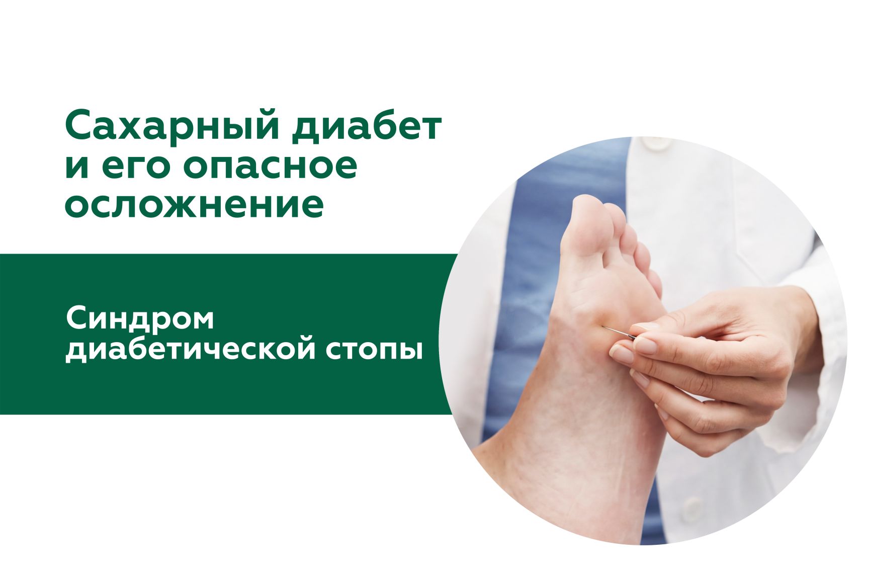 Иллюстрация к статье "Синдром диабетической стопы"